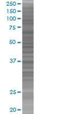 FKHL18 transfected lysate.