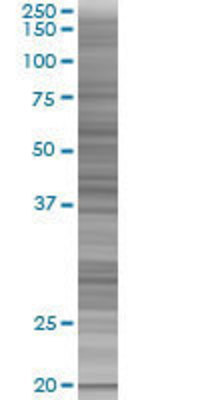 CYB5R3 transfected lysate.