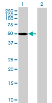 Lane 1: PAK1 transfected lysate (49.28 KDa) Lane 2: Non-transfected lysate.