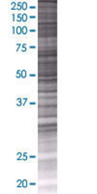 PAK1 transfected lysate.
