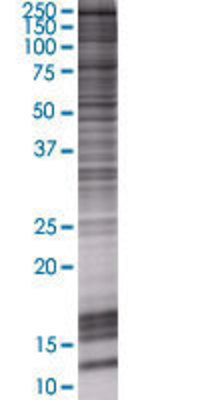 JMJD2B transfected lysate.