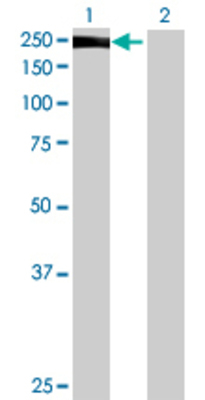 Lane 1: JMJD2B transfected lysate (120.67 KDa) Lane 2: Non-transfected lysate.