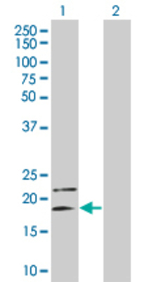 Lane 1: IL4 transfected lysate (16.83 KDa) Lane 2: Non-transfected lysate.