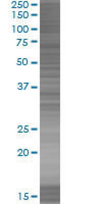 GALE transfected lysate.