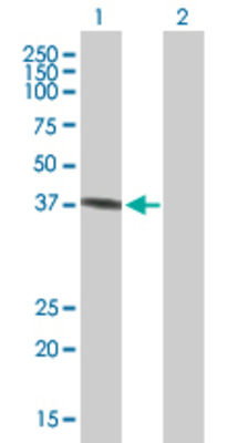 Lane 1: GALE transfected lysate (38.3 KDa) Lane 2: Non-transfected lysate.