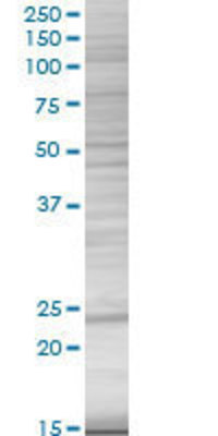 DHFR transfected lysate.