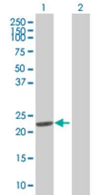 Lane 1: DHFR transfected lysate (21.5 KDa) Lane 2: Non-transfected lysate.