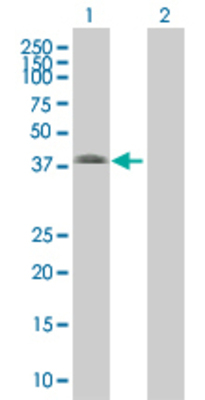 Lane 1: CBX4 transfected lysate (32 KDa) Lane 2: Non-transfected lysate.