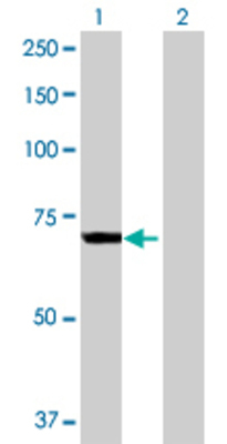 Lane 1: CROT transfected lysate (67.43 KDa) Lane 2: Non-transfected lysate.