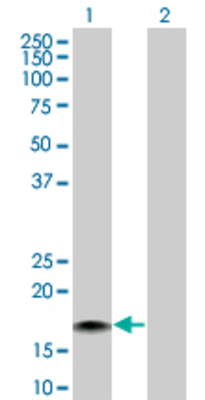 Lane 1: GRIN2C transfected lysate (17.6 KDa) Lane 2: Non-transfected lysate.