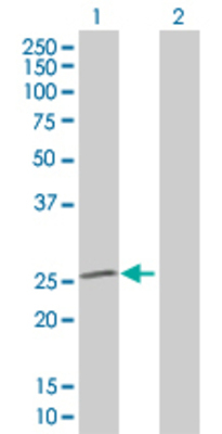 Lane 1: SOD2 transfected lysate (24.8 KDa). Lane 2: Non-transfected lysate.