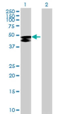 Lane 1: GAL3ST1 transfected lysate (46.64 KDa) Lane 2: Non-transfected lysate.