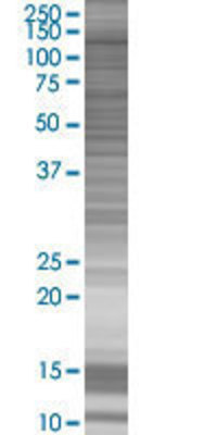 CAMLG transfected lysate.
