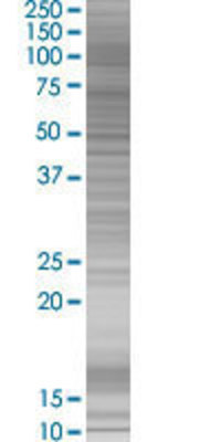 SLC4A1 transfected lysate.
