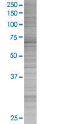 CHEK2 transfected lysate.