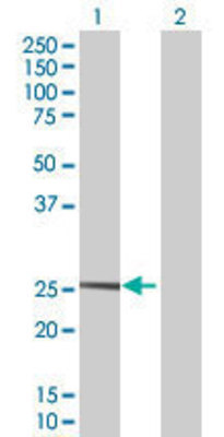 Lane 1: GSTA2 transfected lysate (24.53 KDa) Lane 2: Non-transfected lysate.