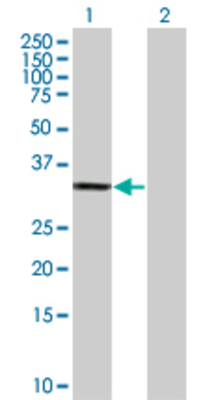 Lane 1: PHYH transfected lysate (38.5 KDa) Lane 2: Non-transfected lysate.