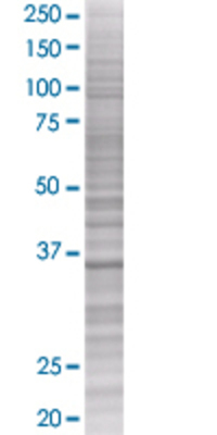 PHYH transfected lysate.