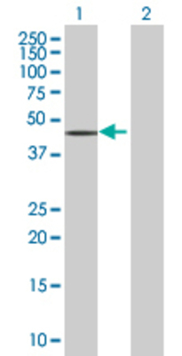 Lane 1: SEPT1 transfected lysate (42 KDa). Lane 2: Non-transfected lysate.