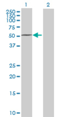 Lane 1: SERPINF2 transfected lysate (54.12 KDa) Lane 2: Non-transfected lysate.