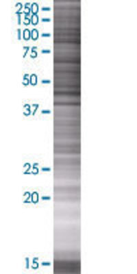 SERPINF2 transfected lysate.
