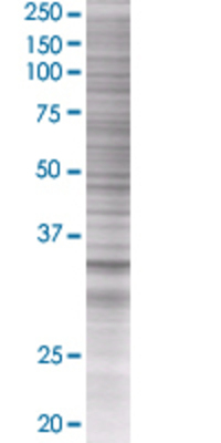 ECH1 transfected lysate.