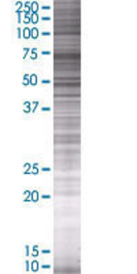 NDN transfected lysate.