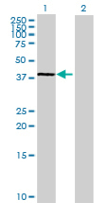 Lane 1: NDN transfected lysate (35.42 KDa) Lane 2: Non-transfected lysate.
