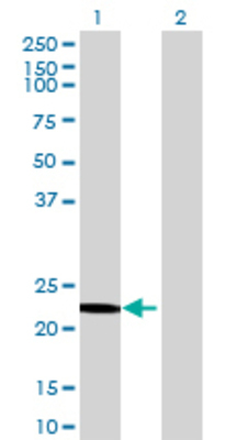 Lane 1: OVCA2 transfected lysate (25.08 KDa) Lane 2: Non-transfected lysate.
