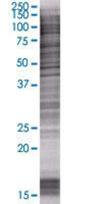OVCA2 transfected lysate.