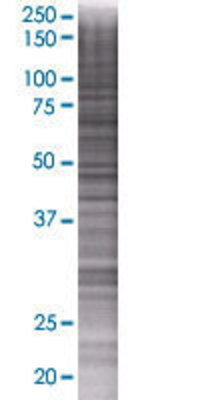 INPP5B transfected lysate.