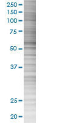 USP3 transfected lysate.