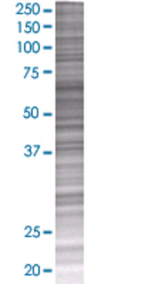 SNAPC2 transfected lysate.