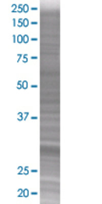 MPPED2 transfected lysate