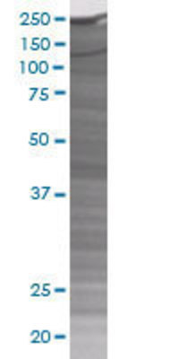 SMARCB1 transfected lysate.