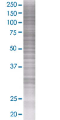 CDK2AP2 transfected lysate.