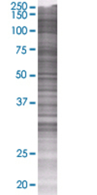 RARS transfected lysate.