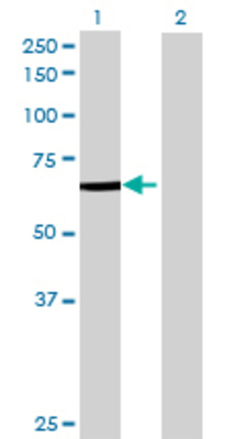 Lane 1: RARS transfected lysate (72.71 KDa) Lane 2: Non-transfected lysate.