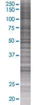 RPAIN transfected lysate.