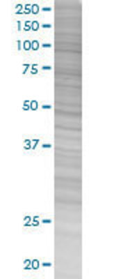 HSD11B1 transfected lysate.