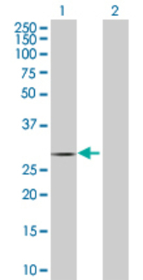 Lane 1: HSD11B1 transfected lysate (32.23 KDa) Lane 2: Non-transfected lysate.