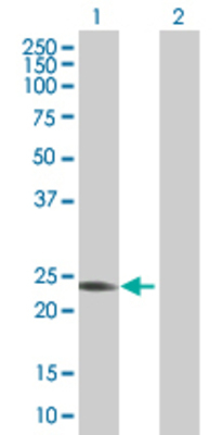 Lane 1: BIN3 transfected lysate (23.2 KDa) Lane 2: Non-transfected lysate.
