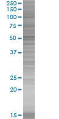 ZNF354A transfected lysate.
