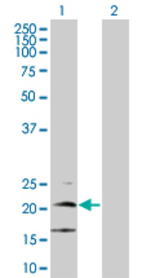 Lane 1: LY86 transfected lysate (17.9 KDa) Lane 2: Non-transfected lysate.