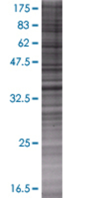 PDS5A transfected lysate.