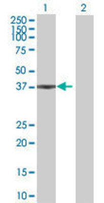 Lane 1: PDS5A transfected lysate (36.74 KDa) Lane 2: Non-transfected lysate.