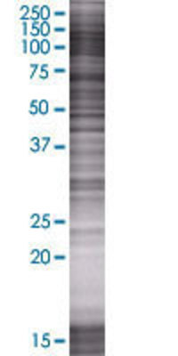 EPB41L3 transfected lysate.