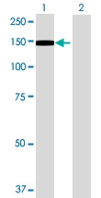 Lane 1: EPB41L3 transfected lysate (95.26 KDa) Lane 2: Non-transfected lysate.