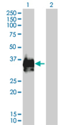 Western Blot: Lane 1: RPA2 Lysate [H00006118-T01]- (29.81 KDa). Lane 2: Non-transfected lysate.
