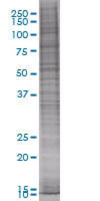 Western blot: RPA2 Lysate [H00006118-T01]
